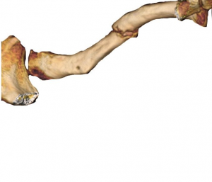 limb reconstruction ricostruzione arti pseudoartrosi